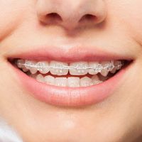 clinicas ortodoncia quito Clínica Odontológica Cabezas